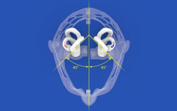 Dizzy Head kit + 2CSC