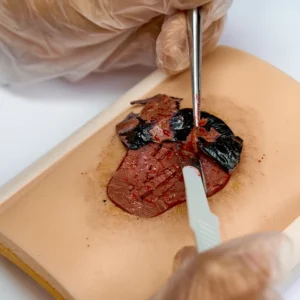 Skin pad with Pressure Ulcer Pad de piel de simulación clinica