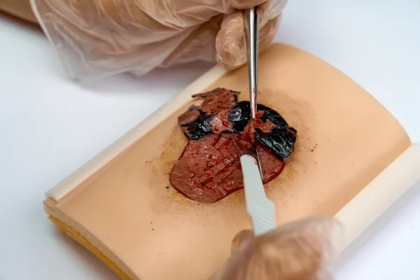 Skin pad with Pressure Ulcer Pad de piel de simulación clinica