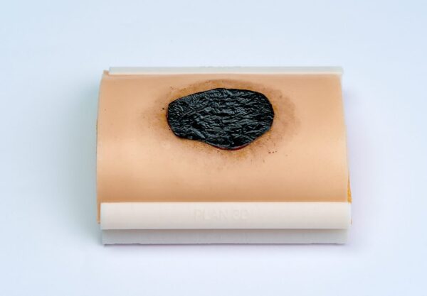 simulador ulcera 01 The pressure ulcer skin pad