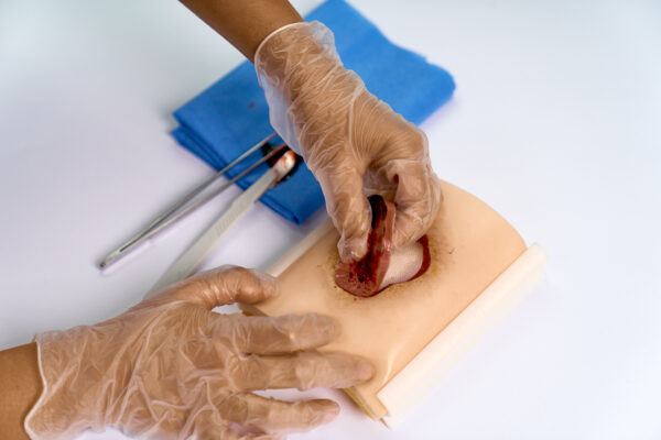 simulador ulcera 02 The pressure ulcer skin pad