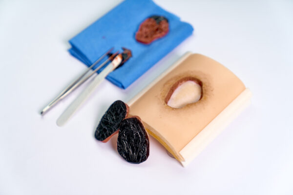 simulador ulcera 03 The pressure ulcer skin pad