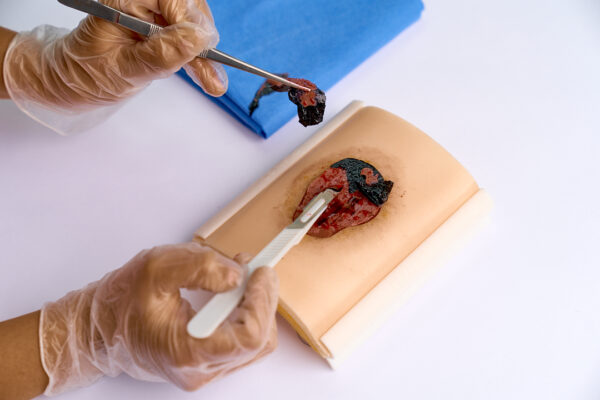 simulador ulcera 04 The pressure ulcer skin pad