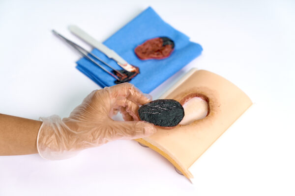 simulador ulcera 06 The pressure ulcer skin pad