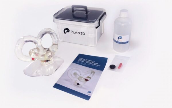 Semicircular canal with moving otholits big size (Right side)