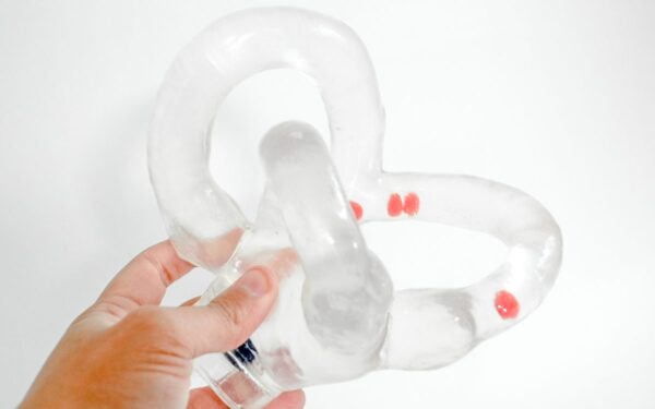 Semicircular canal with moving otholits big size (Right side)