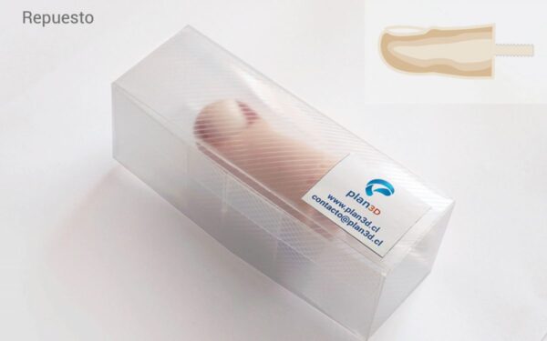 Onychocryptosis Replacement