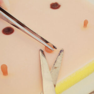 Fibroids and moles skin pad