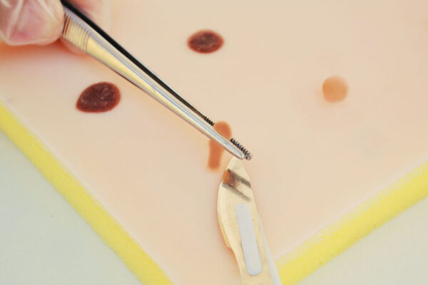 Fibroids and moles skin pad