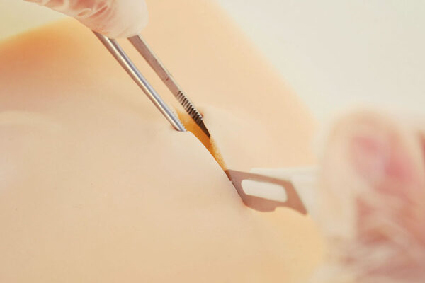 1 Cyst + 1 Lipoma skin pad