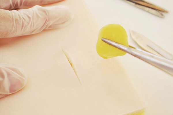 1 Cyst + 1 Lipoma skin pad