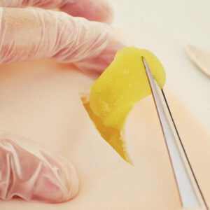 Skin pad with lipomas 1 Cyst + 1 Lipoma skin pad