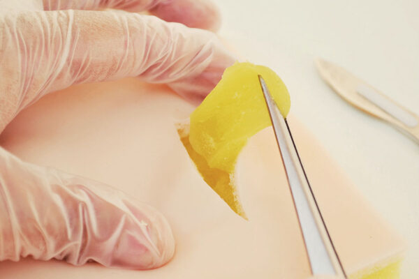 1 Cyst + 1 Lipoma skin pad