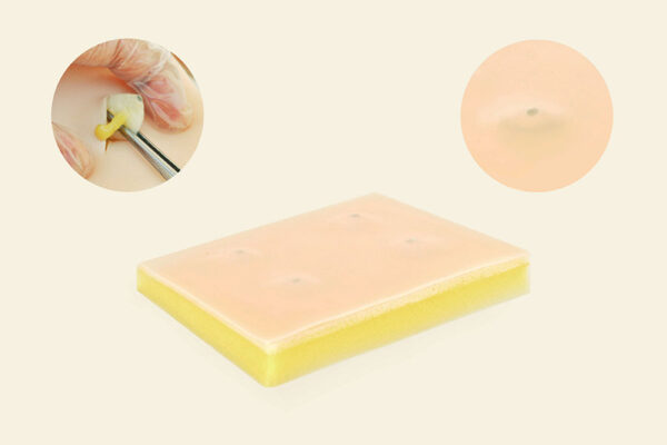 piel quistes 01 1 Cyst + 1 Lipoma skin pad