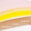 Three-layer skin for suturing