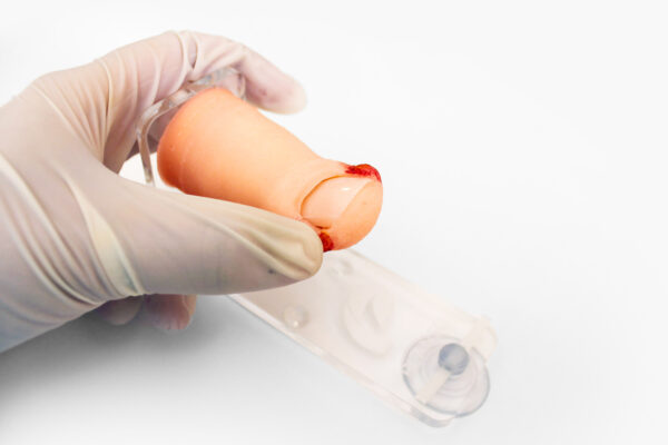 Onychocryptosis simulator