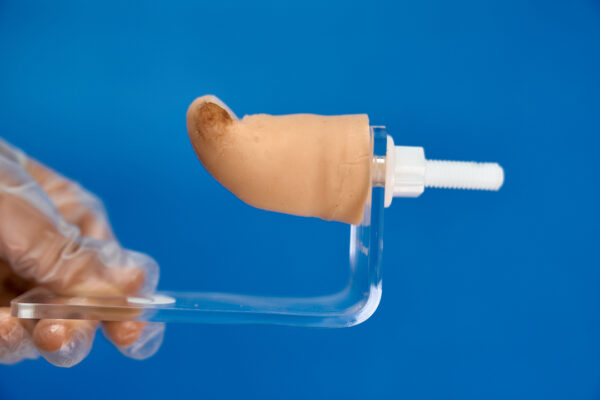 Onychocryptosis simulator