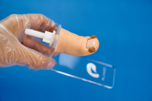 Onychocryptosis simulator