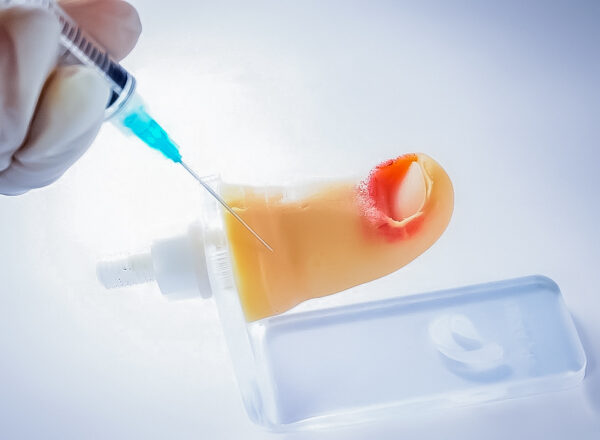 Onychocryptosis simulator