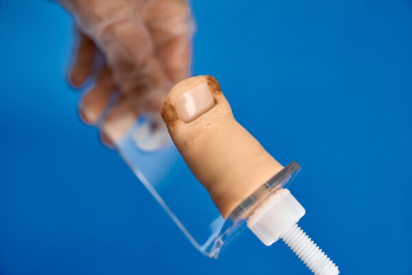 Onychocryptosis simulator