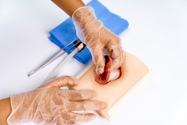 advancedulcer_02 The advanced pressure ulcer skin pad