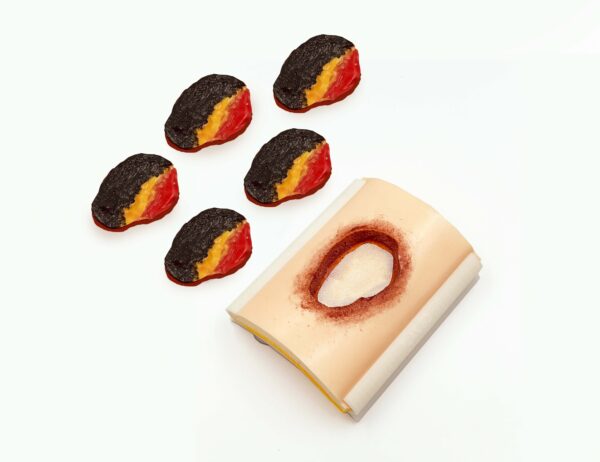 advancedulcer_03 The advanced pressure ulcer skin pad