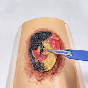 advancedulcer_04 The advanced pressure ulcer skin pad