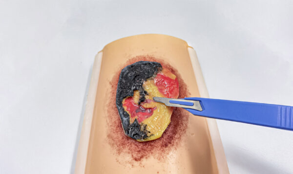 advancedulcer_04 The advanced pressure ulcer skin pad