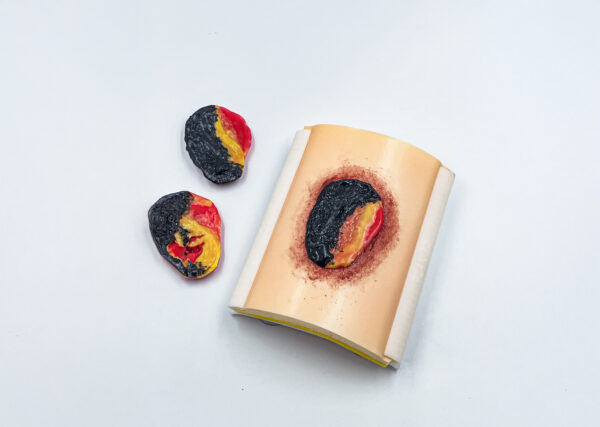 advancedulcer_05 The advanced pressure ulcer skin pad