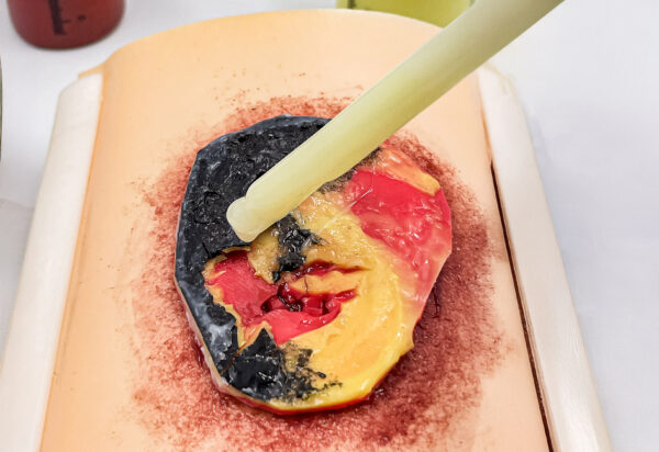 advancedulcer_06 The advanced pressure ulcer skin pad