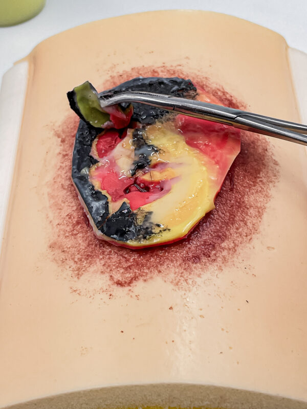 advancedulcer_07 The advanced pressure ulcer skin pad