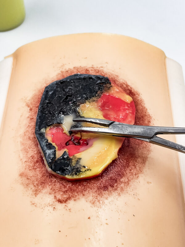 advancedulcer_08 The advanced pressure ulcer skin pad