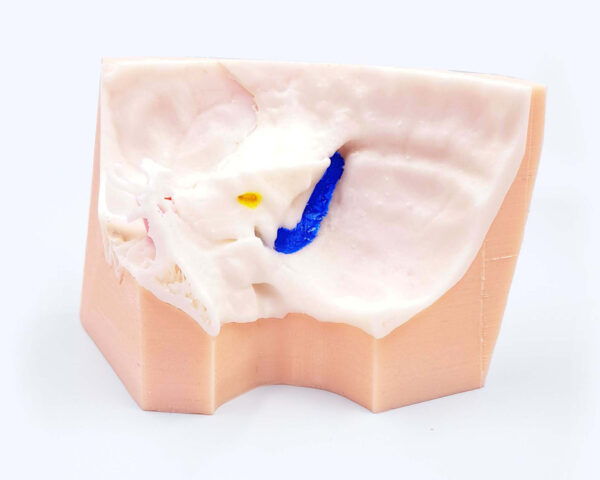 inner_ear_02 Inner ear simulator