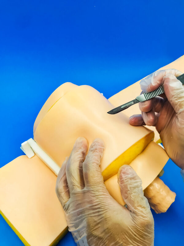 Obese patient's skin